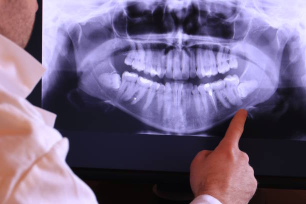 Best Orthodontic Emergency Dentist in Travilah, MD