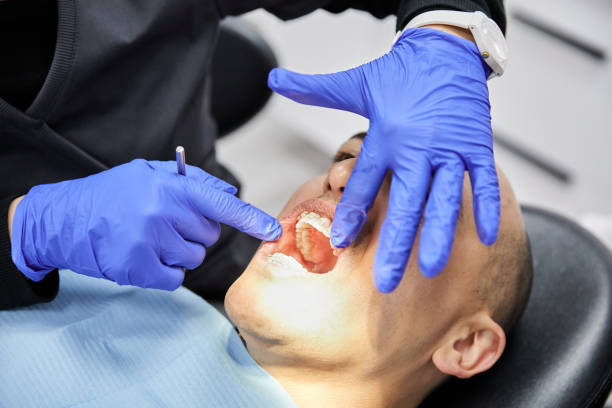 Best Emergency Dentist for Knocked-Out Tooth in Travilah, MD